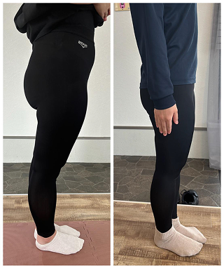 施術後のビフォーアフター