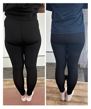 施術後のビフォーアフター